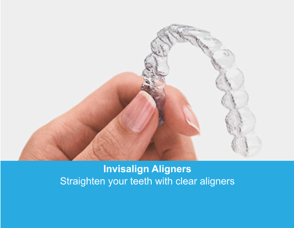 Invisalign Aligners Straighten your teeth with clear aligners