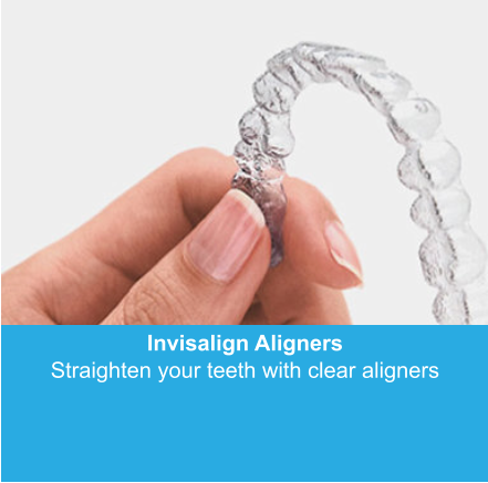 Invisalign Aligners Straighten your teeth with clear aligners